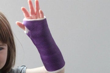 Broken Wrist